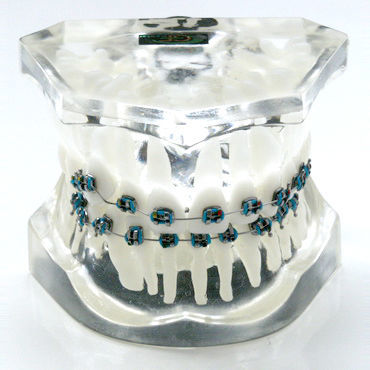 牙齿解剖模型 - OTB5 - GF DENTAL - 牙齿矫正 / 培训 / 树脂
