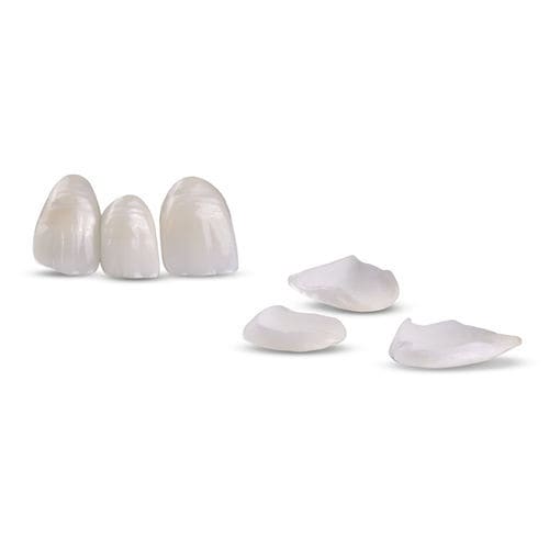 陶瓷牙科材料 - Veneers - Glidewell Europe - 氧化锆 / 焦硅酸锂 / 牙齿修复