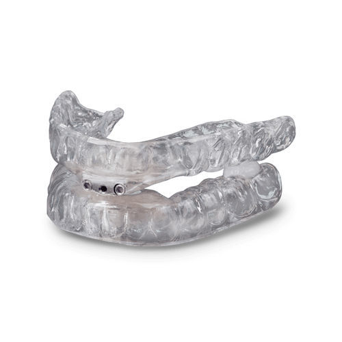排水沟槽止鼾器 - TAP® 3 TL - Glidewell Europe