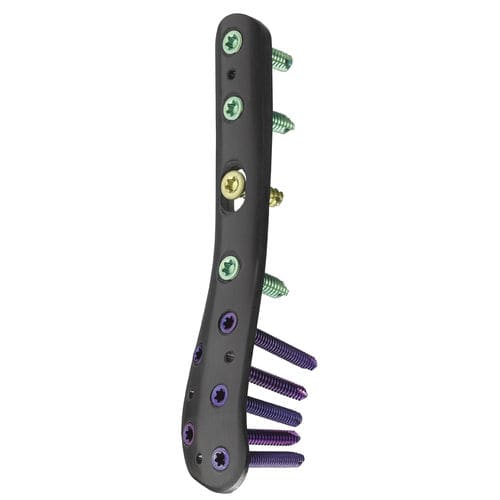 腓骨加压接骨板 - CarboFix Orthopedics - 远侧 / 锁定 / 未锁定
