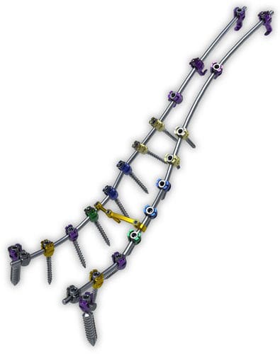 胸腰骶椎脊柱内固定系统 - Lancer™ - ChoiceSpine - 后入路