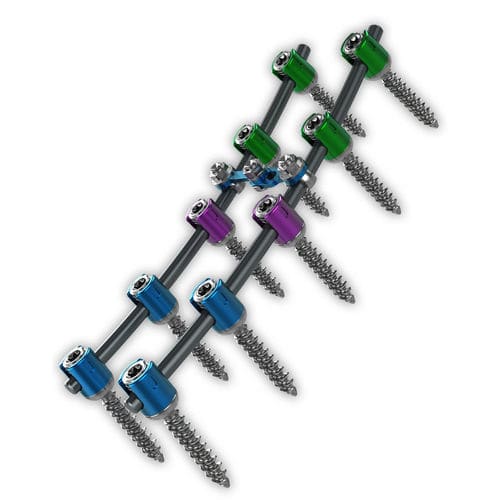 胸腰椎脊柱内固定系统 - Proliant® - ChoiceSpine - 后入路