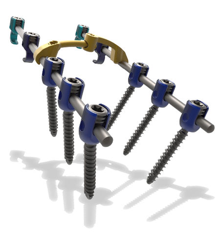 颈胸廓脊柱内固定系统 - Blackbird™ - ChoiceSpine - 后入路