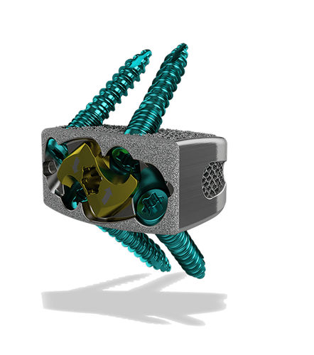 腰椎间融合器 - Harrier® SA - ChoiceSpine - 前入路 / 钛 / 3D印刷