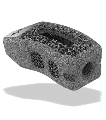 腰椎间融合器 - TigerShark® Threaded TL  - ChoiceSpine - 椎间孔内 / 钛 / 3D印刷