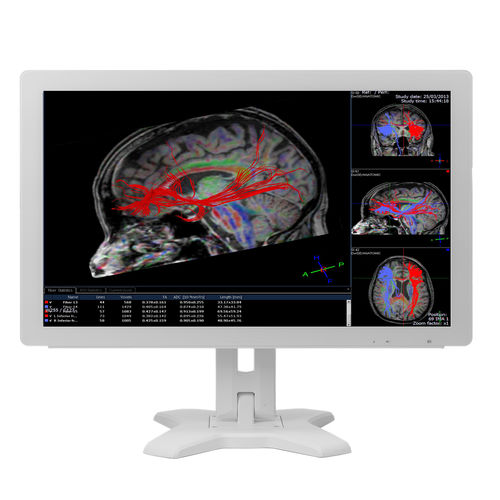 医用显示器 - MMS-21CAHST  - BriteMED Technology - 医学成像 / 医学模拟 / 全高清Full HD