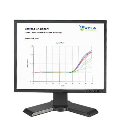 分析软件 - Sentosa SA - Vela Diagnostics - 判断框 / 分子生物