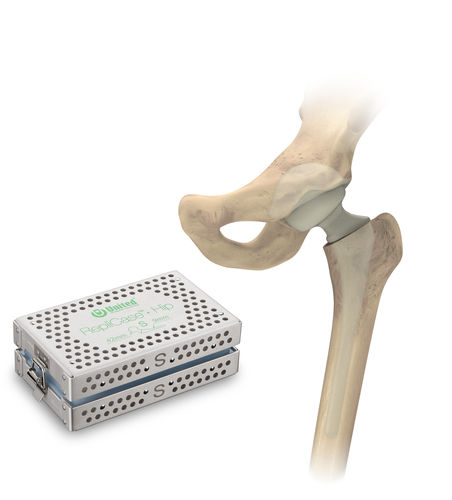 髋关节临时占位器 - RepliCase™ - US Orthopedics