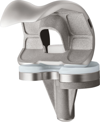 三间隔膝关节假体 - U2™  - US Orthopedics - 固定轴承