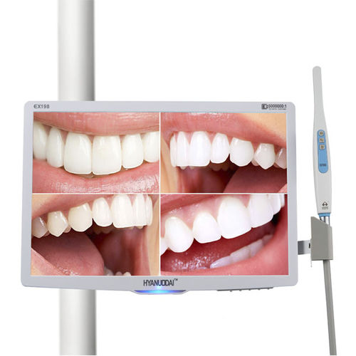 口腔内摄像机 - ANTAR Dental Manufacturer - 数字 / CMOS / 带LCD屏幕
