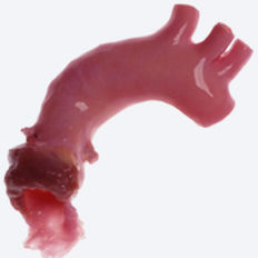 主动脉生物人工血管 - CryoValve® - Cryolife - 同种异体移植 / 活瓣