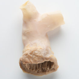 肺动脉生物人工血管 - CryoValve® SG - Cryolife - 同种异体移植 / 活瓣