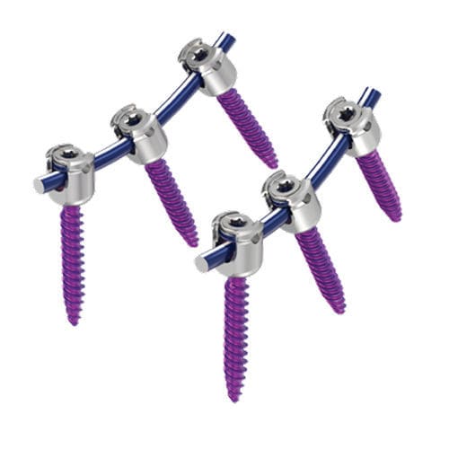 胸腰椎脊柱内固定系统 - MAS® - NuVasive - 后入路