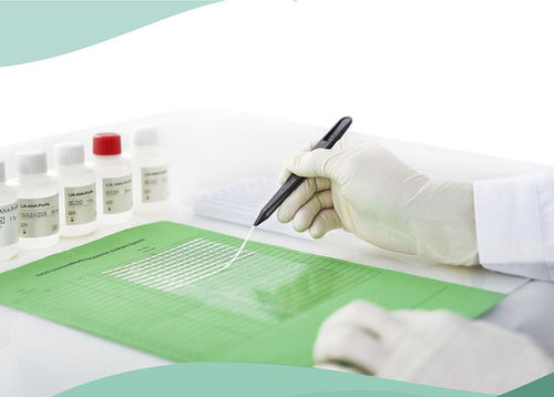 自身免疫性疾病试剂带 - Shenzhen Yhlo Biotech Co., Ltd. - 肝脏疾病 / 糖尿病 / 脉管炎