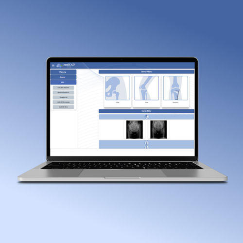 医疗管理软件 - medc-web-70 series - mediCAD Hectec GmbH - 规划 / 术前统筹 / 骨科