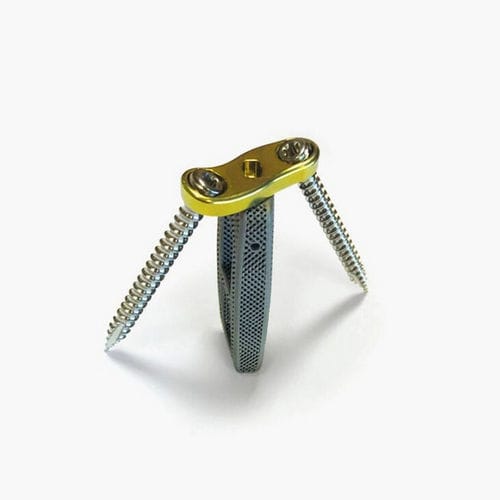 腰椎间融合器 - Idys®-LLIF 3DTi - Clariance - 侧方入路 / 钛 / 带腰椎骨板