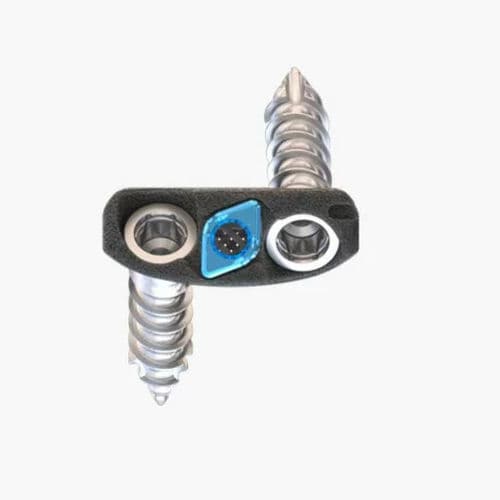 颈椎间融合器 - Idys®-C ZP 3DTi - Clariance - 前入路 / 钛
