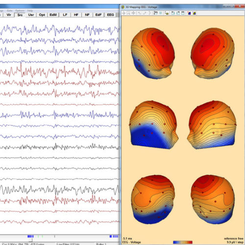 脑电图用软件 - Research 7.1 - BESA GmbH - 核磁共振MRI / 分析 / 3D 可视化