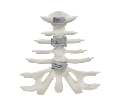 胸骨加压接骨板 - KontourTalon ® - Kontour Medical Technology - 钛