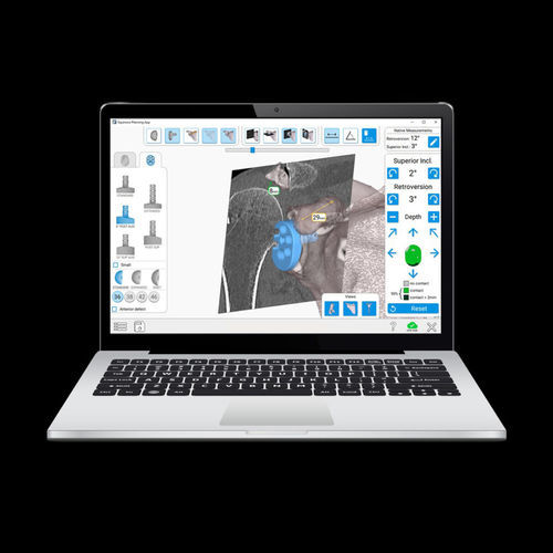 肩部定位手术导航系统 - Equinoxe®GPS® - Exactech - 光学