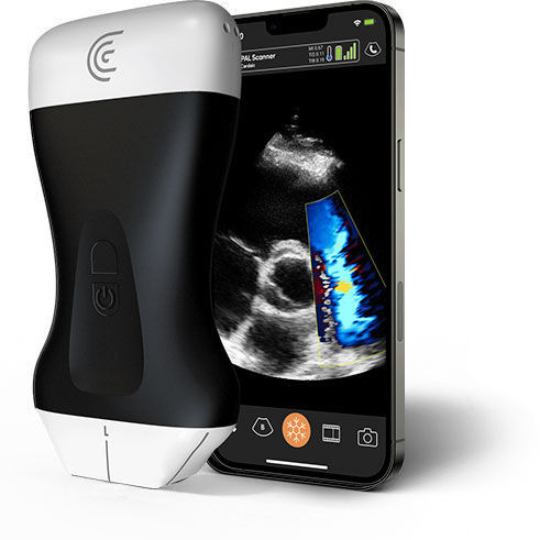 手持式B超机 - PAL - Clarius Mobile Health - 用于多功能超声检查 / 彩色多普勒 / 黑白
