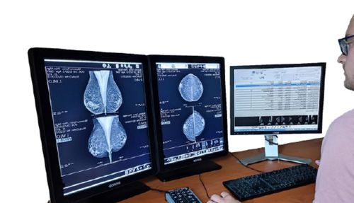 诊断软件 - MED MAMMO - Medecom - 医用 / PACS（医学影像系统） / 乳腺X射线造影
