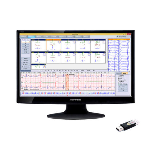 医疗管理软件 - BORSAM Biomedical Instrument - 分析 / 报告 / 打印机