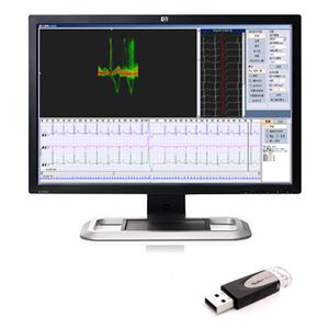 医学报告软件 - iTengo+  - BORSAM Biomedical Instrument - 分析 / 带心电图 / 用于医院
