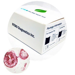 FOB快速诊断检测 - N040 series - NTBIO Diagnostics - 用于癌症 / 肿瘤科 / 肿瘤标记物
