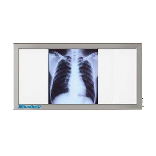 3联X光片观片灯 - NT 130 - SCHRODER HEALTH PROJECTS - 白光