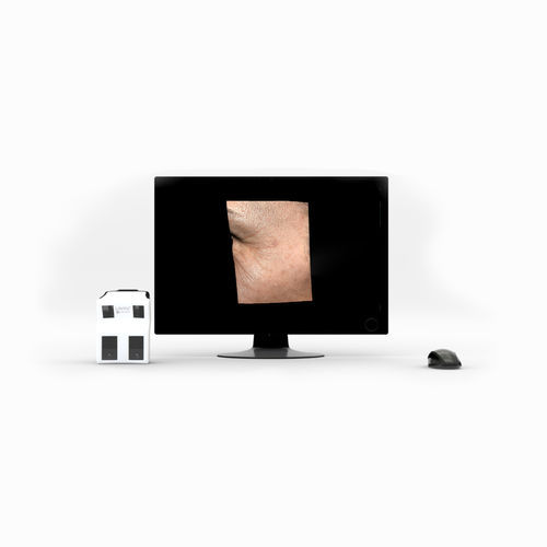 面部3D成像皮肤诊断系统 - LifeViz® Micro - Quartier Latin