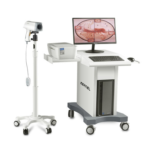 视频阴道镜 - KN-2200 - Kernel Medical Equipment Co., Ltd - 推车式