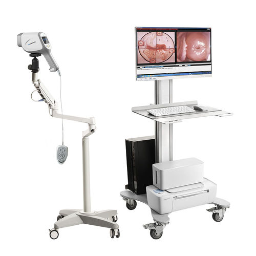 视频阴道镜 - KN-2200A - Kernel Medical Equipment Co., Ltd - 推车式