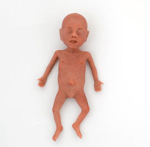 儿科护理医学教学模型 - NENASim Preemie - MEDICAL-X - 用于复苏术 / 新生儿