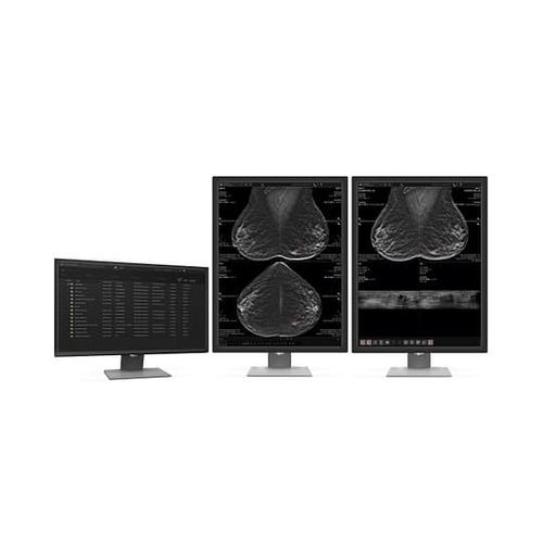 医用软件 - MammoScape™ - VAREX Imaging - CT计算机断层扫描 / 放射学 / 乳腺X射线造影