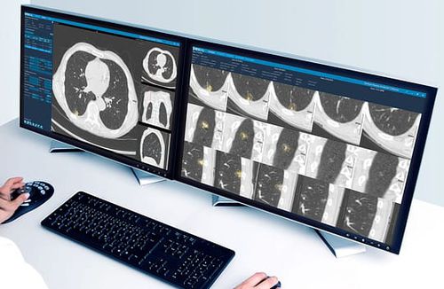 医用软件 - Veolity - VAREX Imaging - 放射学 / 图像分析 / 管理