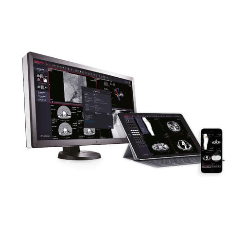 医用软件 - MedDream DICOM Viewer - MEDDREAM - 用于医院 / PACS（医学影像系统） / 通用