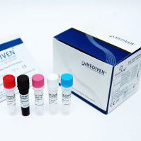 登革热快速诊断套装 - GenoAmp&reg; GRA2006 - Medical Innovation Ventures - 用于病毒 / 血清 / 等离子