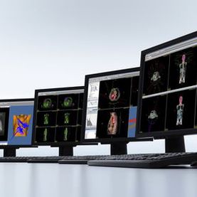 医疗可视化软件 - DICOM RT Studio - PTW Freiburg Physikalisch-Technische-Werkstätten - 加工 / 用于放射疗法