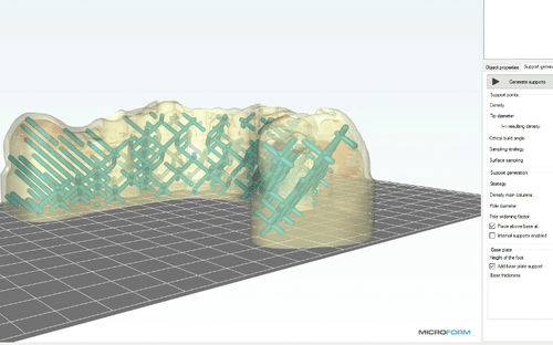 牙科软件 -  MicroForm® - Microlay - 3D 可视化 / 导入 / 3D 打印