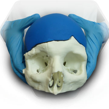 定制颅内植入物 - SkullPT  - 3D Side