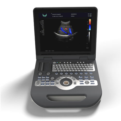 便携式B超机 - XF3500 - Xianfeng Ultrasound Medical - 用于多功能超声检查 / 黑白 / 彩色多普勒