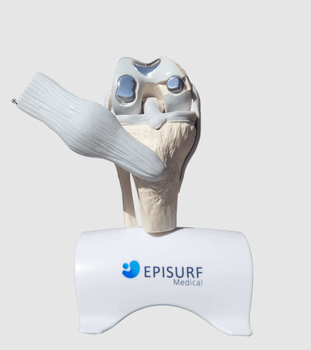 膝盖整形假体 - Episurf Medical - 解剖型 / 钴铬