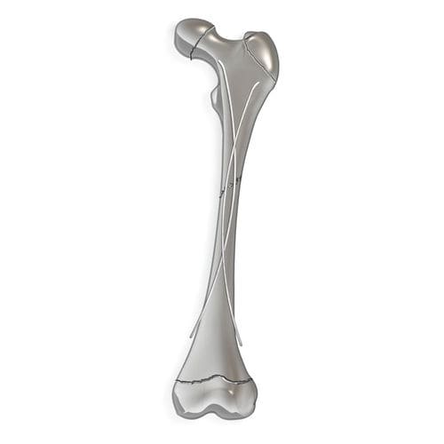 股骨髓内钉 - pediFlex™ - OrthoPediatrics - 胫骨 / 腓骨 / 肱骨