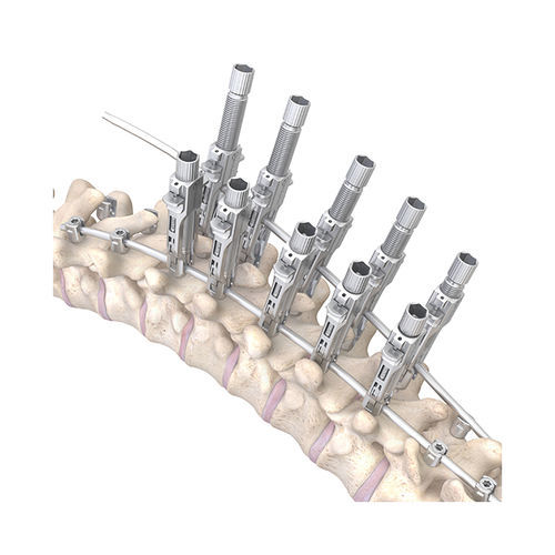 胸腰椎脊柱内固定系统 - RESPONSE™ 5.5/6.0 - OrthoPediatrics - 后入路 / 儿科