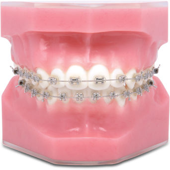 钛镍矫正线材 - TP Orthodontics - 不锈钢 / 钛