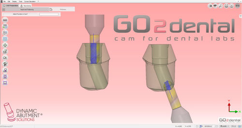 牙科实验室软件 - GO2dental - Dynamic Abutment Solutions - CAM