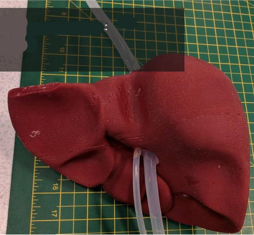 肝脏解剖模型 - 3D Lifeprints UK Ltd - 机器人辅助外科手术 / 培训