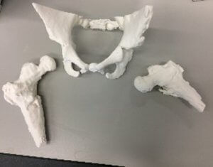 骨骼解剖模型 - 3D Lifeprints UK Ltd - 骨盆 / 股骨 / 手术