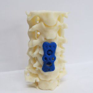 腰脊柱解剖模型 - 3D Lifeprints UK Ltd - 用于脊柱手术